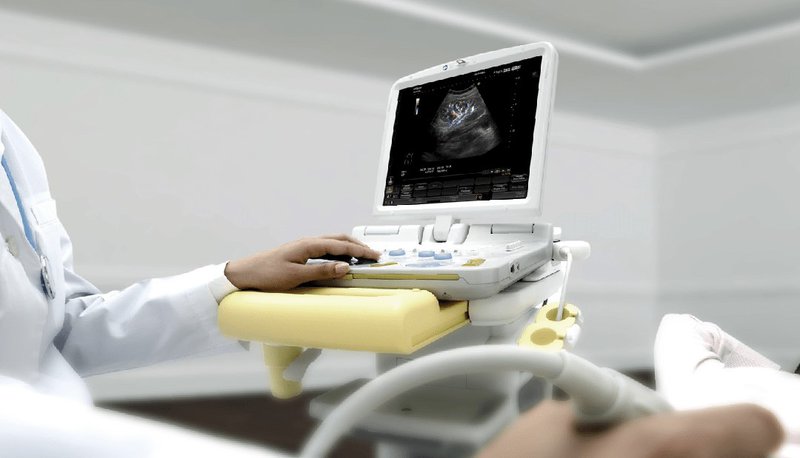 Endoscopic Ultrasound