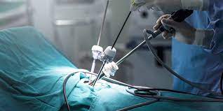 Surgical Endoscopy Systems